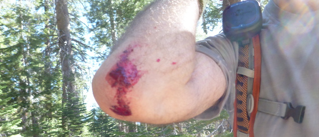 Bloody elbow on the John Muir Trail
