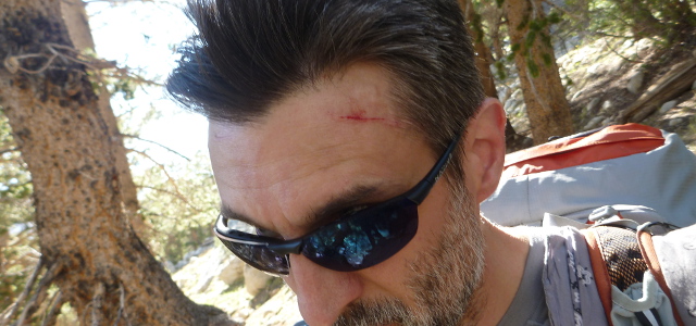 The author, with another laceration on his forehead.